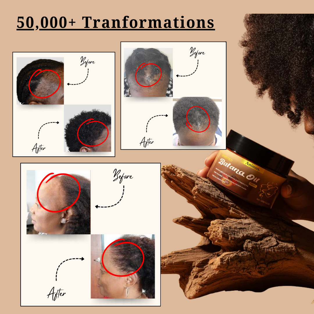 Batana Natural Hair Growth Oil