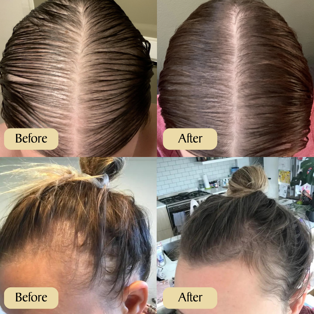 Batana Natural Hair Growth Oil