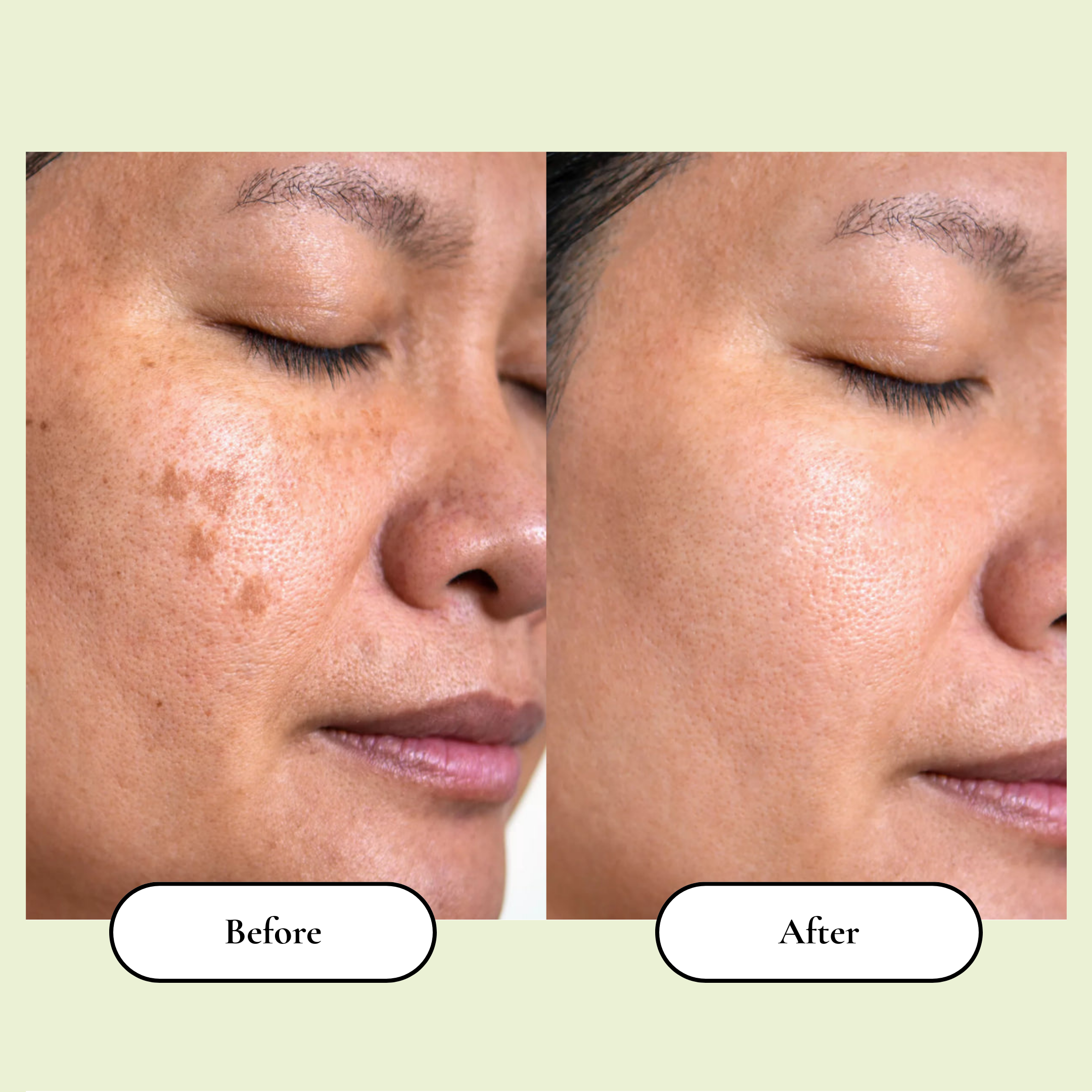 Korean Skincare Toner Pads