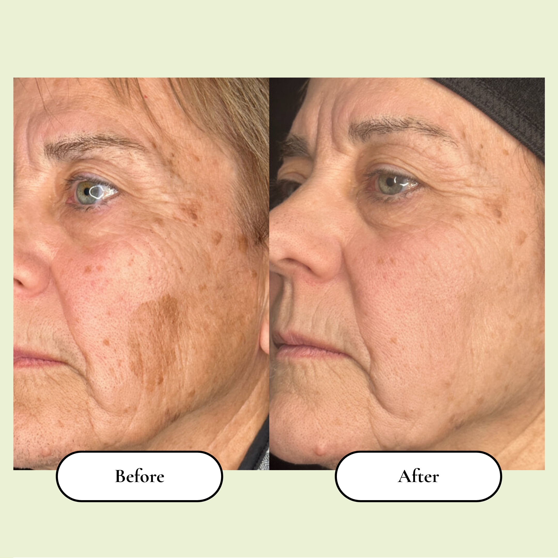 Korean Skincare Toner Pads